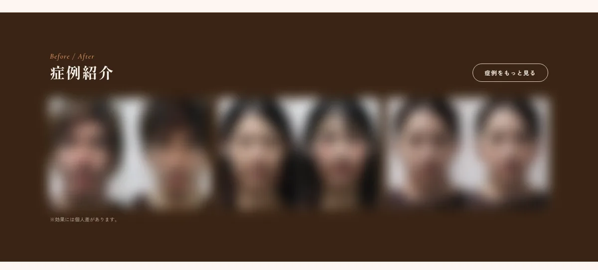 症例(ビフォーアフター)(2026年10月)